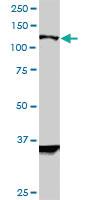 Anti-HIP1R Mouse Monoclonal Antibody [clone: 3E10]