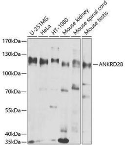 Anti-ANKRD28 antibody