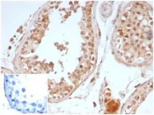 Immunohistochemical analysis of formalin-fixed, paraffin-embedded human testis tissue using Anti-OCT-4 Antibody [OCT4/6875R]. Inset: PBS instead of the primary Antibody. Secondary Antibody negative control