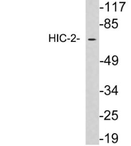 Anti-HIC-2 antibody