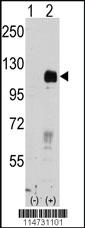 Anti-EPHB4 Rabbit Polyclonal Antibody