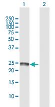 Anti-SSPN Rabbit Polyclonal Antibody