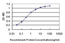 Anti-HIP1R Mouse Monoclonal Antibody [clone: 3E10]