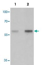 Anti-HEPACAM2 Rabbit Polyclonal Antibody