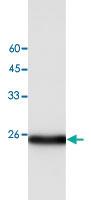 Anti-ARHGDIB Mouse Monoclonal Antibody [clone: 16]