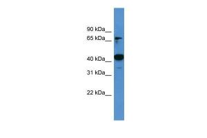 Anti-ASCC1 Rabbit Polyclonal Antibody