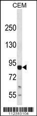 Anti-MAP3K13 Rabbit Polyclonal Antibody (HRP (Horseradish Peroxidase))