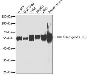 Western blot analysis of extracts of various cell lines, using Anti-TRK fused gene Antibody (A307553) at 1:1000 dilution. The secondary Antibody was Goat Anti-Rabbit IgG H&L Antibody (HRP) at 1:10000 dilution. Lysates/proteins were present at 25 µg per lane