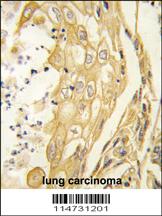 Anti-EPHB4 Rabbit Polyclonal Antibody