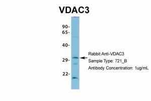 Anti-VDAC3 Rabbit Polyclonal Antibody