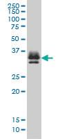 Anti-ST3GAL2 Mouse Monoclonal Antibody [clone: 1E12]