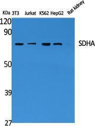 Western blot analysis of various cells using Anti-SDHA Antibody