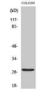 Western blot analysis of various cells using Anti-TP53INP1 Antibody