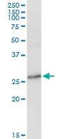 Anti-SSPN Rabbit Polyclonal Antibody