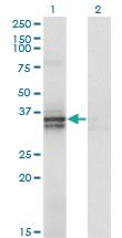 Anti-ST3GAL2 Mouse Monoclonal Antibody [clone: 1E12]