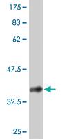 Anti-ABL2 Mouse Monoclonal Antibody [clone: 2H8]