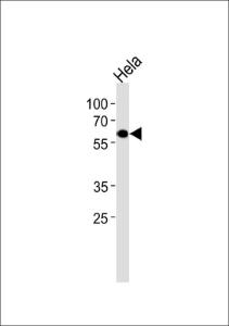 Anti-ESRRG Rabbit Polyclonal Antibody