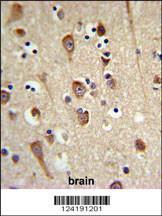 Anti-LUC7L2 Rabbit Polyclonal Antibody (HRP (Horseradish Peroxidase))