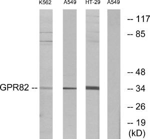 Western blot analysis of lysates from A549, K56 and HT-29 cells using Anti-GPR82 Antibody. The right hand lane represents a negative control, where the antibody is blocked by the immunising peptide