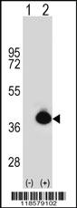 Anti-POLDIP2 Rabbit Polyclonal Antibody