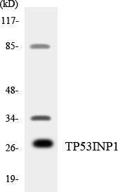 Western blot analysis of the lysates from HT 29 cells using Anti-TP53INP1 Antibody