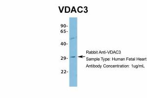 Anti-VDAC3 Rabbit Polyclonal Antibody