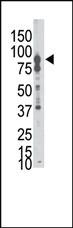 Anti-EPHB6 Rabbit Polyclonal Antibody