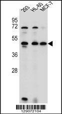 Anti-ANKRD40 Rabbit Polyclonal Antibody (Biotin)