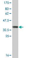 Anti-SULT1B1 Mouse Monoclonal Antibody [clone: 4C9]