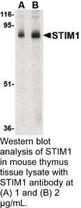 Anti-STIM1 Rabbit Polyclonal Antibody