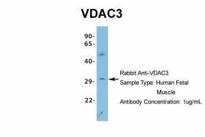 Anti-VDAC3 Rabbit Polyclonal Antibody