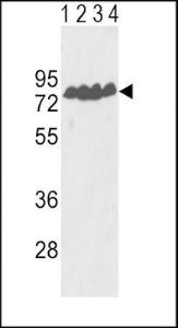 Anti-ECE1 Rabbit Polyclonal Antibody