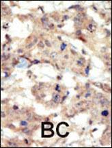 Anti-EPHB6 Rabbit Polyclonal Antibody