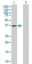 Anti-EXTL2 Mouse Polyclonal Antibody