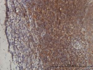 Anti-ST3GAL2 Mouse Monoclonal Antibody [clone: 1E12]