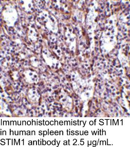 Anti-STIM1 Rabbit Polyclonal Antibody