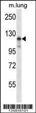 Anti-MAP3K14 Rabbit Polyclonal Antibody (APC (Allophycocyanin))