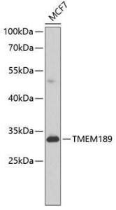 Western blot analysis of extracts of MCF-7 cells, using Anti-PEDS1 Antibody (A10411) at 1:1,000 dilution