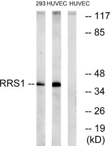 Western blot analysis of lysates from HUVEC and 293 cells using Anti-RRS1 Antibody. The right hand lane represents a negative control, where the antibody is blocked by the immunising peptide.