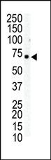 Anti-EPHB6 Rabbit Polyclonal Antibody