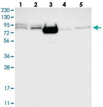 Anti-FOXK1 Rabbit Polyclonal Antibody