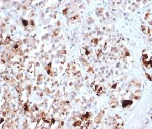 Immunohistochemical analysis of formalin-fixed, paraffin-embedded human pituitary tissue using Anti-Prolactin Antibody [PRL/4906R]