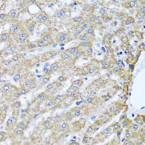 Immunohistochemistry analysis of paraffin-embedded human liver using Anti-PEDS1 Antibody (A10411) at a dilution of 1:100 (40X lens). Perform microwave antigen retrieval with 10 mM PBS buffer pH 7.2 before commencing with IHC staining protocol