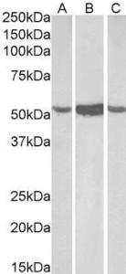 Anti-ALDH1A1 antibody