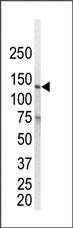 Anti-EGFR Rabbit Polyclonal Antibody