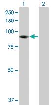 Anti-PIBF1 Mouse Polyclonal Antibody