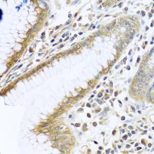 Immunohistochemistry analysis of paraffin-embedded human stomach using Anti-PEDS1 Antibody (A10411) at a dilution of 1:100 (40X lens). Perform microwave antigen retrieval with 10 mM PBS buffer pH 7.2 before commencing with IHC staining protocol