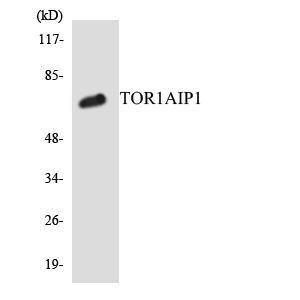 Western blot analysis of the lysates from COLO205 cells using Anti-TOR1AIP1 Antibody