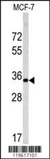 Anti-EMD Rabbit Polyclonal Antibody