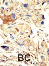 Anti-EGFR Rabbit Polyclonal Antibody